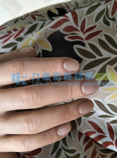 美容假肢手指价格